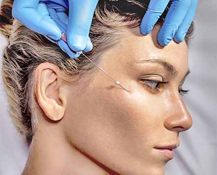 curso de hilos de pdo dra Laura